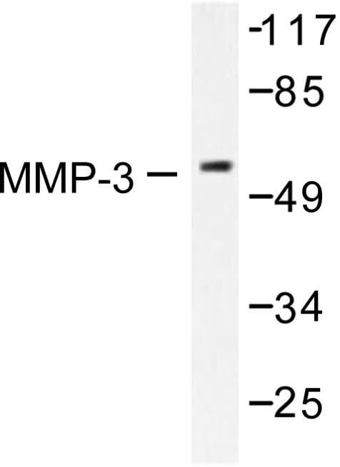 MMP3 Antibody (Ser453)