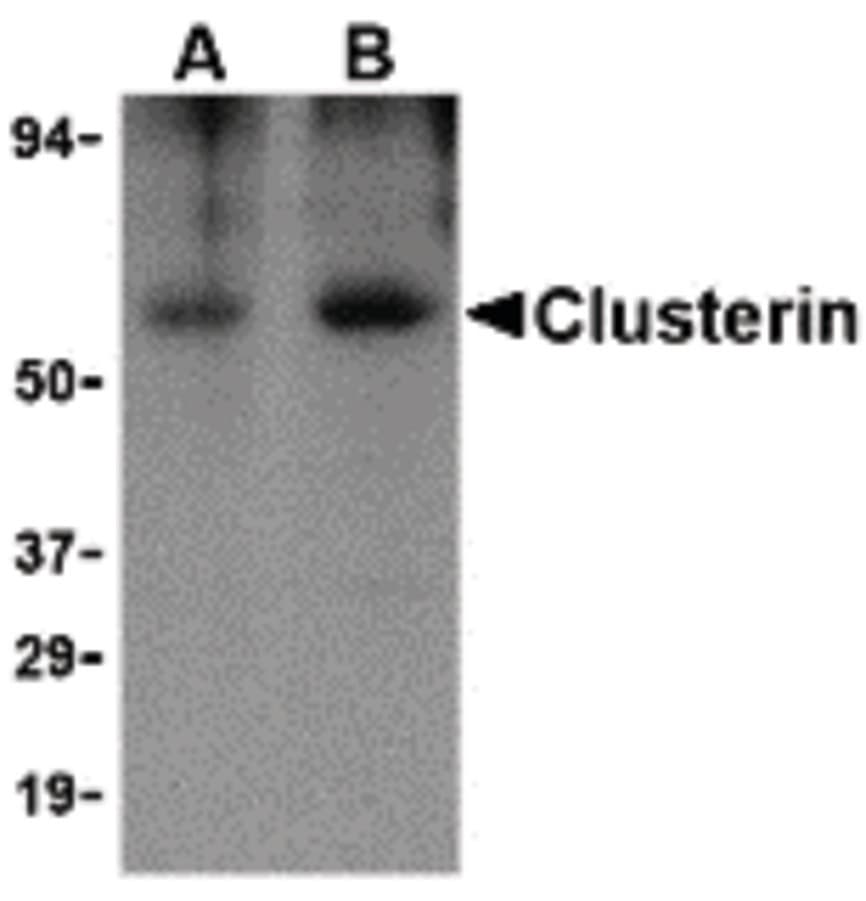 CLU / Clusterin Antibody
