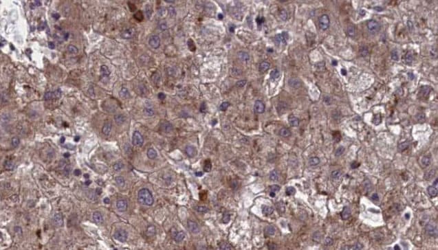 Polyclonal Rabbit anti-Human OR7E24 Antibody (IHC, WB)