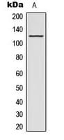 ACAD10 Antibody (Internal)