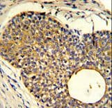 Polyclonal Rabbit anti-Human APOBEC3A Antibody (aa1-30, IHC, WB)