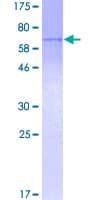 Human ERCC2 / XPD Protein (Recombinant GST)