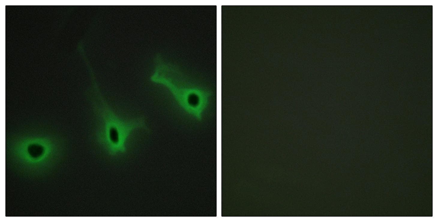 Polyclonal Rabbit anti-Human COL5A3 / Collagen V Alpha 3 Antibody (IHC, IF)