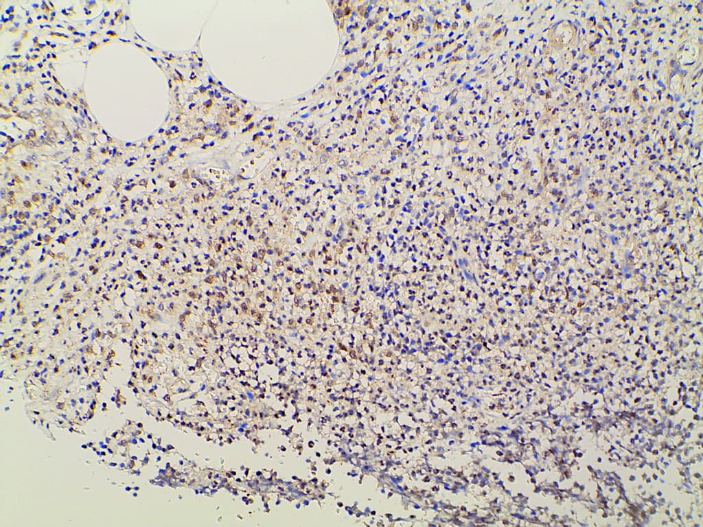 EFNB2 / Ephrin B2 Antibody
