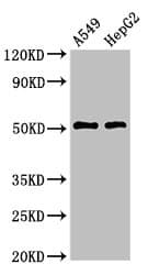 Tyrosine Aminotransferase Antibody
