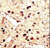 Polyclonal Rabbit anti-Human AURKB / Aurora-B Antibody (aa6-35, IHC, WB)