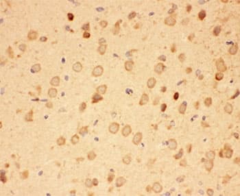 HSP90AA1 / Hsp90 Alpha A1 Antibody (aa2-365)