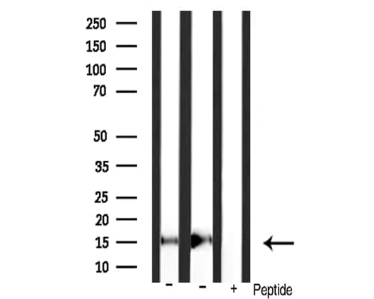 Polyclonal Rabbit anti-Human Histone H3 Antibody (Acetyl-Lys18, IHC, IF, WB)