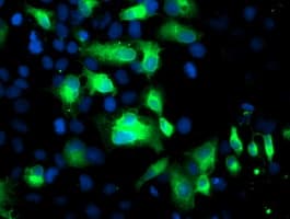 FGFR2 / FGF Receptor 2 Antibody (clone OTI3F8)