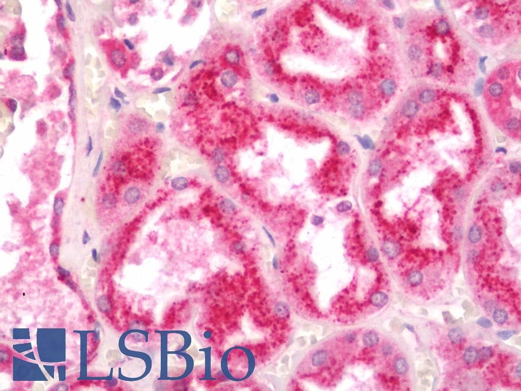 IHC-plus™ Polyclonal Rabbit anti-Human WWC1 / KIBRA Antibody (IHC, IF, WB)