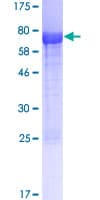 Human SLC9A3R1 / NHERF1 / EBP50 Protein (Recombinant GST)
