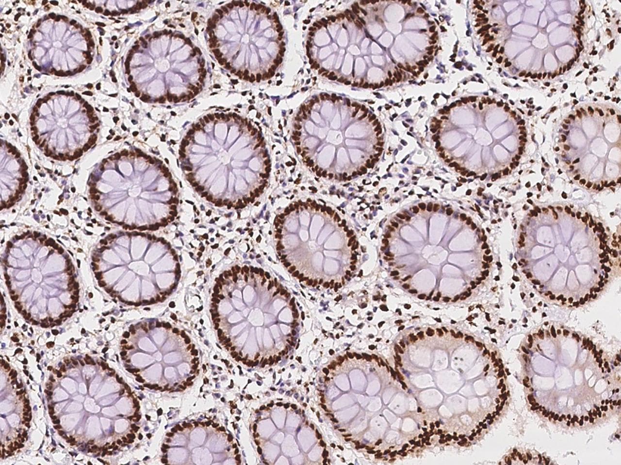 SARNP / Hcc-1 / CIP29 Antibody