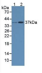 RAD51 / RECA Antibody (aa2-339)