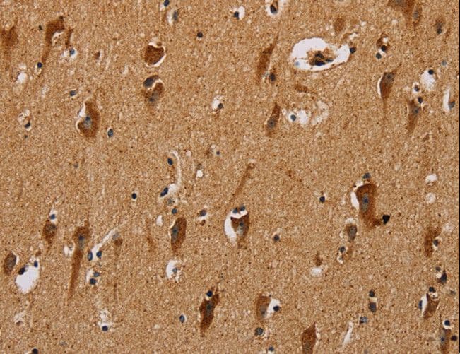 Polyclonal Rabbit anti-Human NDUFS3 Antibody (IHC, WB)