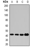 Polyclonal Rabbit anti-Human PPM1A / PP2CA Antibody (IF, WB)