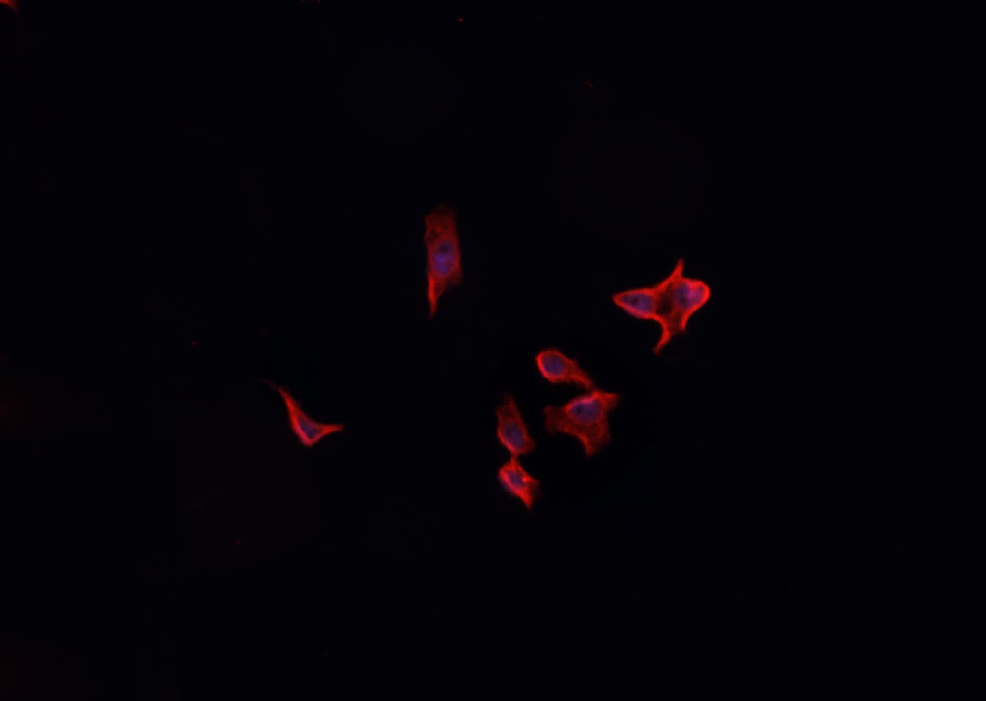 CSTB / Cystatin B / Stefin B Antibody