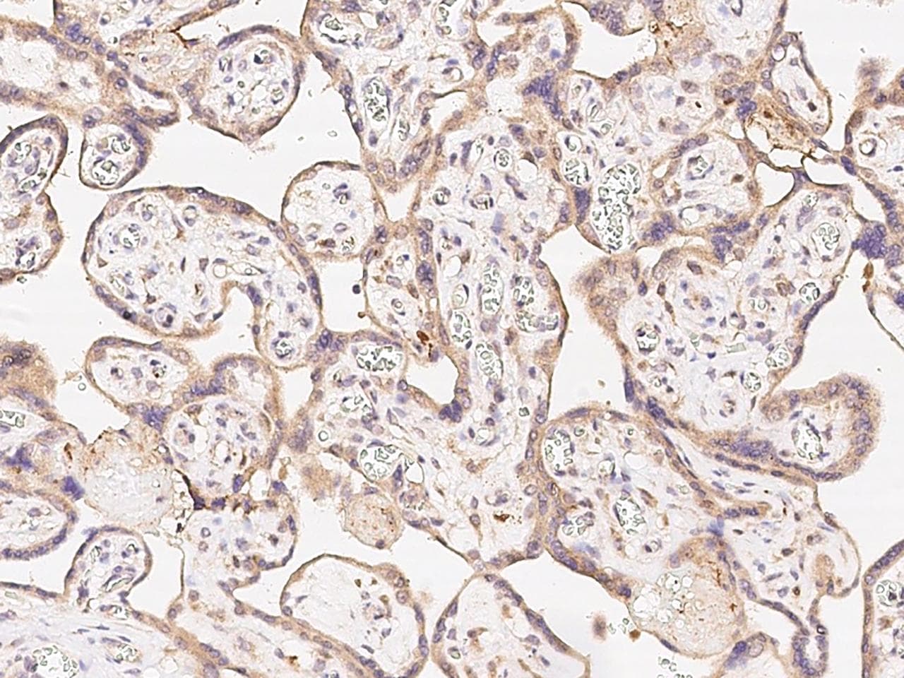 PTPN2 / TC-PTP Antibody (Preservative Free)