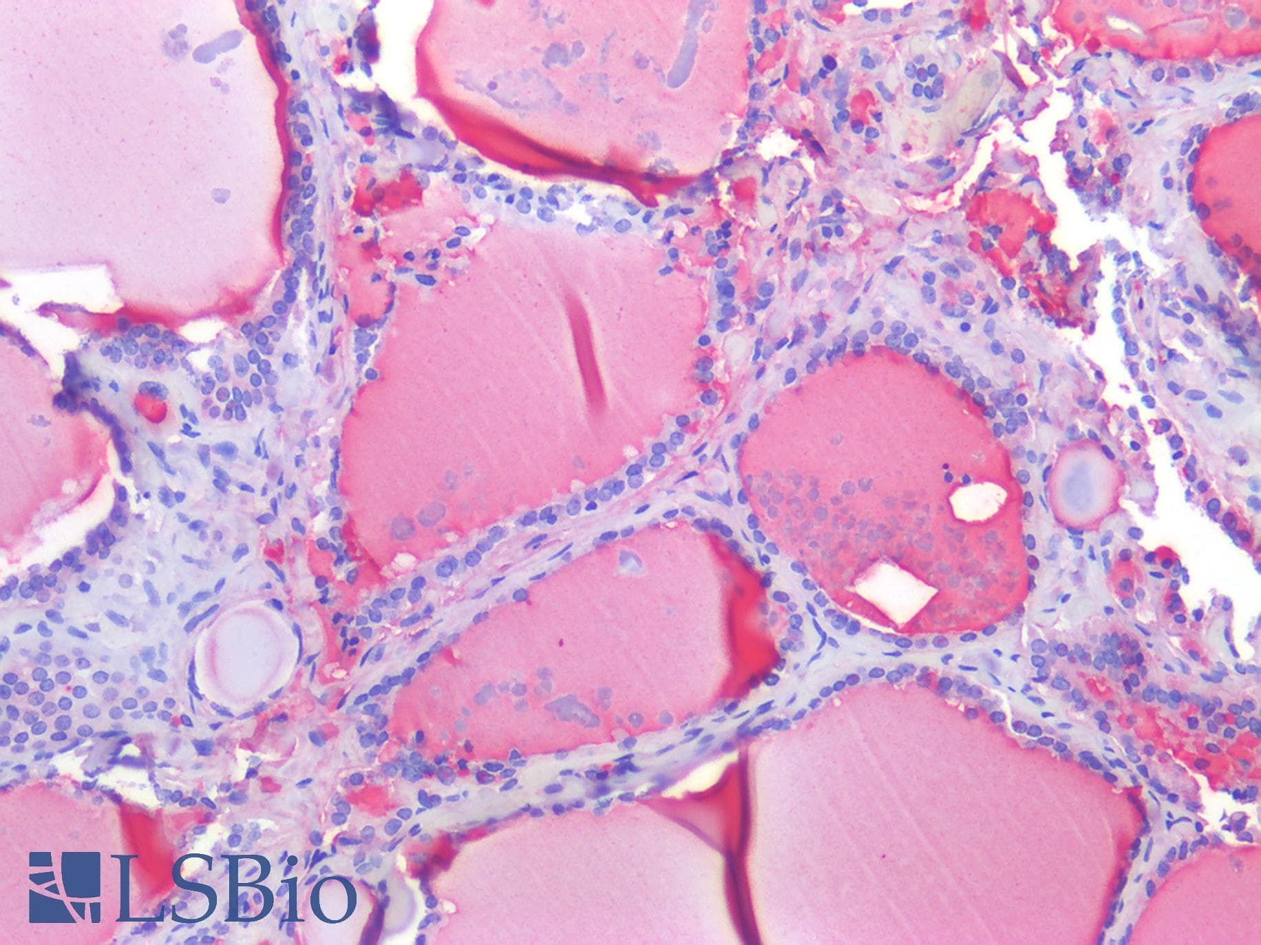 PathPlus™ Polyclonal Rabbit anti-Human OCLN / Occludin Antibody (aa35-84, IHC, WB)