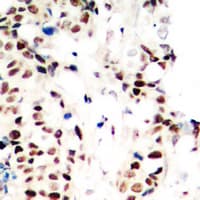 RPA2 / RFA2 / RPA34 Antibody (N-Terminus)