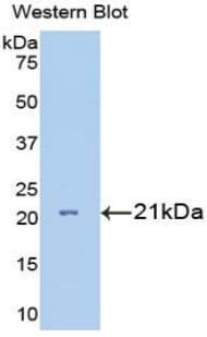 IL7R / CD127 Antibody (aa48-217, Cy3)
