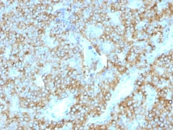 PTH / Parathyroid Hormone Antibody (C-Terminus, clone PTH/1175)