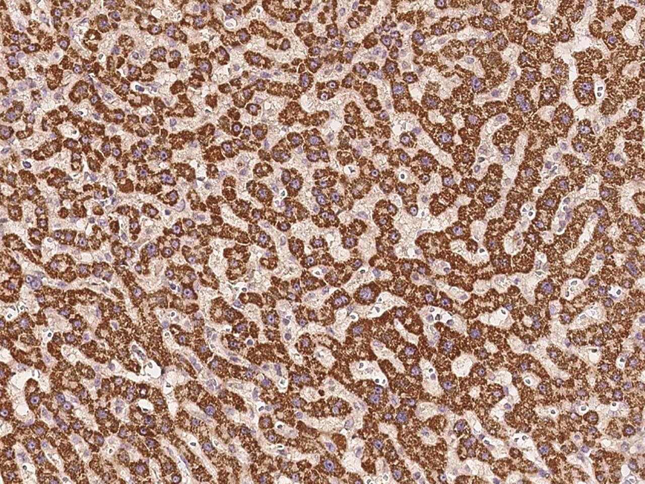 Polyclonal Rabbit anti-Human TNFRSF19 / TROY Antibody (Preservative Free, IHC)