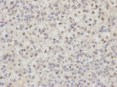 Polyclonal Rabbit anti-Human DDB2 Antibody (IHC, IF, WB)
