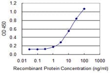 ACOT7 / BACH Antibody (clone 1E7)