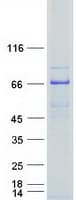 Human PGM3 Protein (Recombinant Myc-DDK (Flag))