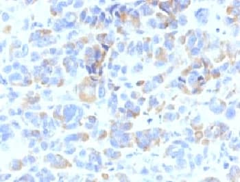 TYRP1 / gp75 Antibody (clone TYRP1/807)