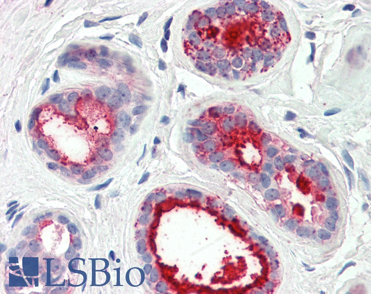 PathPlus™ PIP / GCDFP-15 Antibody (1-50 aa, Internal)