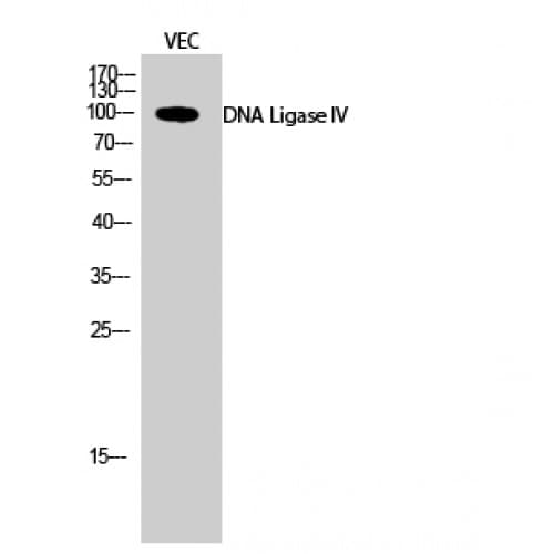 LIG4 / DNA Ligase IV Antibody (560-640 aa, Internal)