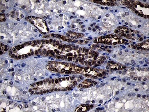 Monoclonal Mouse anti-Human RRM2 Antibody (clone OTI1F2, IHC, WB)