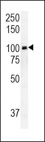 RASGRP1 / RASGRP Antibody (aa495-521)