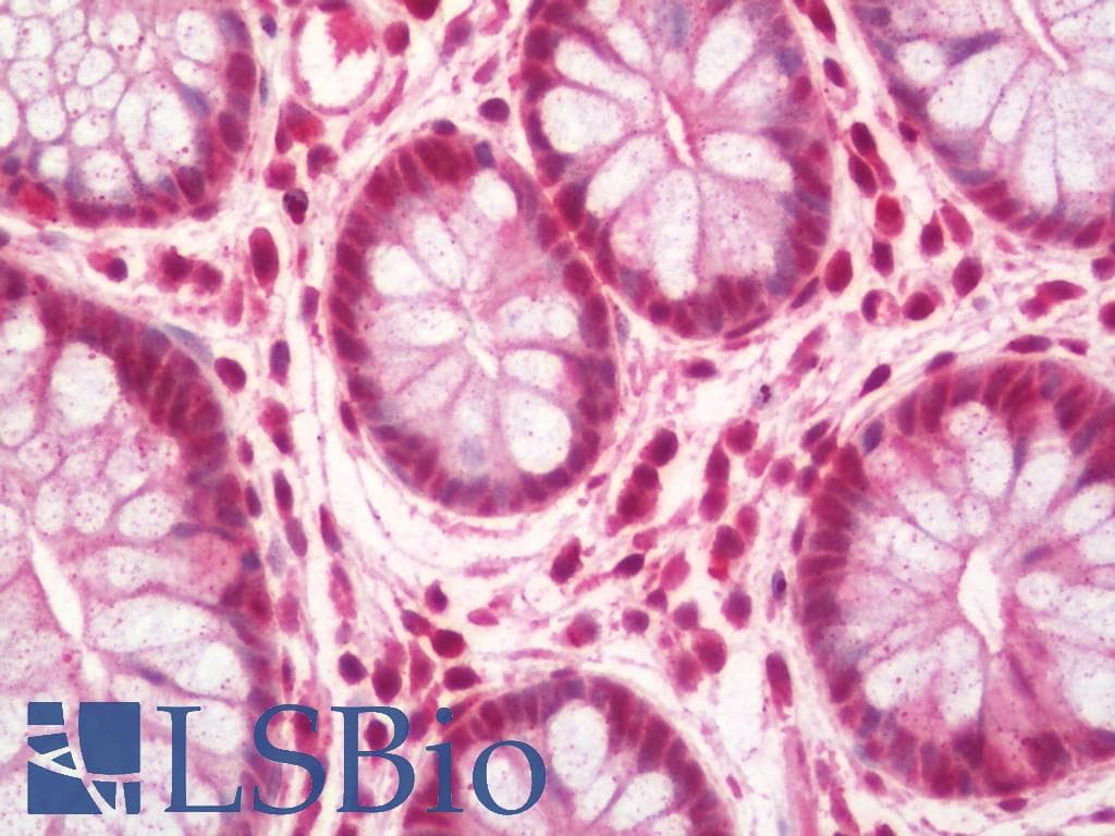 IHC-plus™ DIRAS3 / ARHI Antibody