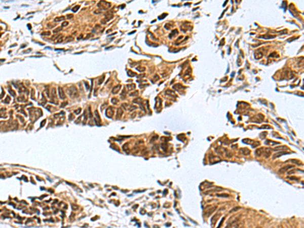 PDCD5 Antibody