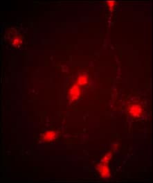Polyclonal Rabbit anti-Human CLCN4 / CLC-4 Antibody (aa663-689, IF, WB)
