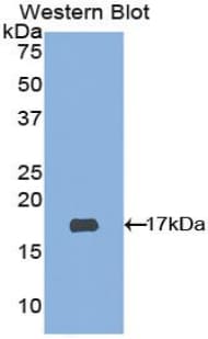 ADAMTS2 Antibody (aa474-610, PE)