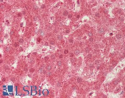 IHC-plus™ Polyclonal Rabbit anti-Human UBXD9 / ASPL Antibody (IHC, IF, WB)