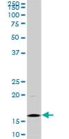 IHC-plus™ HIST1H3D Antibody (clone 1D8)