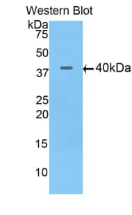 FSHB / FSH Beta Antibody (aa21-129, APC)