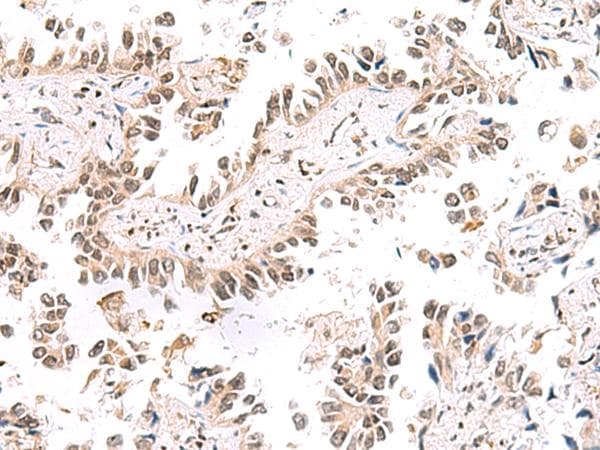 KCTD13 Antibody