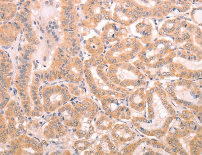 TRPC3 Antibody