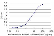 DNTT / TdT Antibody (clone 4H5)