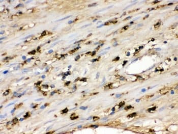 Polyclonal Rabbit anti-Human S100A9 / MRP14 Antibody (IHC, WB)