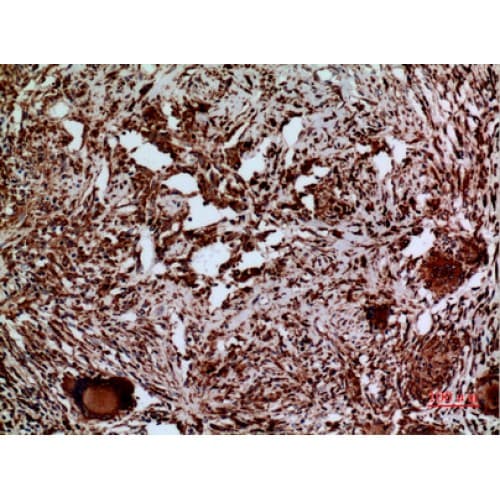 LAMC2 / Laminin Gamma 2 Antibody (C-terminal)