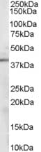 IHC-plus™ Polyclonal Goat anti-Human SORD / Sorbitol Dehydrogenase Antibody (aa345-357, IHC, WB)