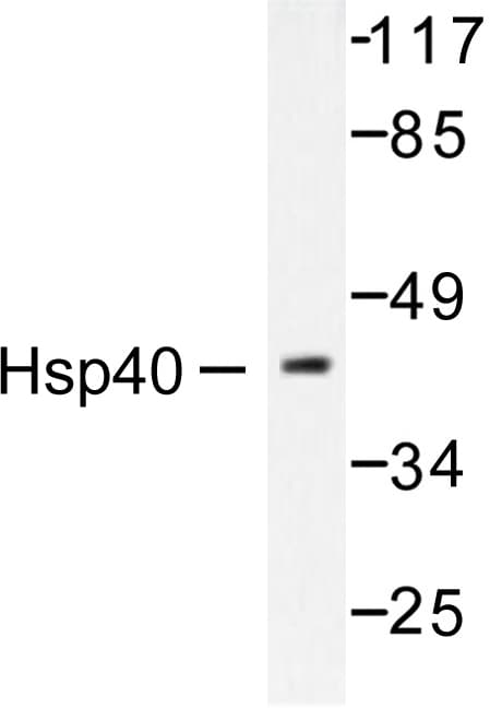 Polyclonal Rabbit anti-Human DNAJB1 / Hsp40 Antibody (Pro303, IHC, IF, WB)