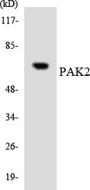 Polyclonal Rabbit anti-Human PAK2 Antibody (aa141-190, WB)
