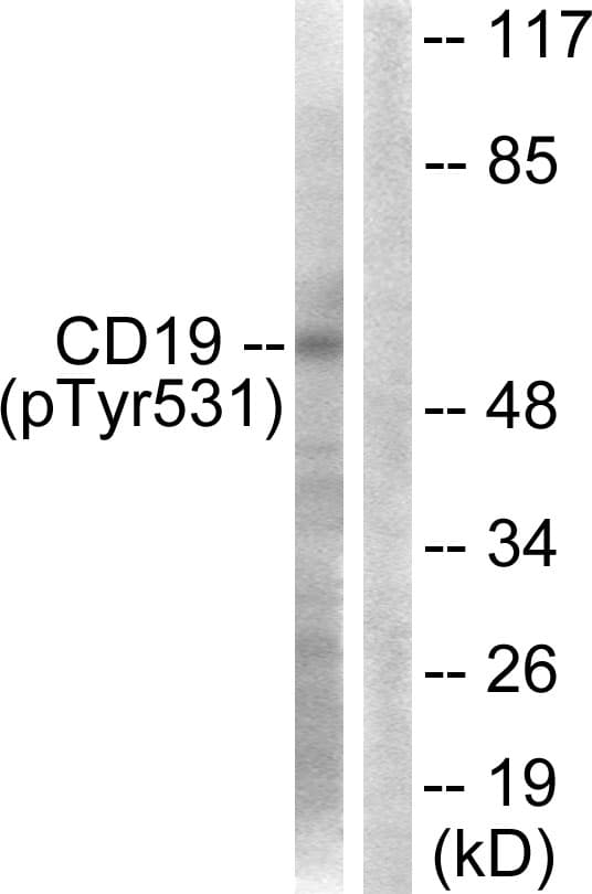 CD19 Antibody (phospho-Tyr531)